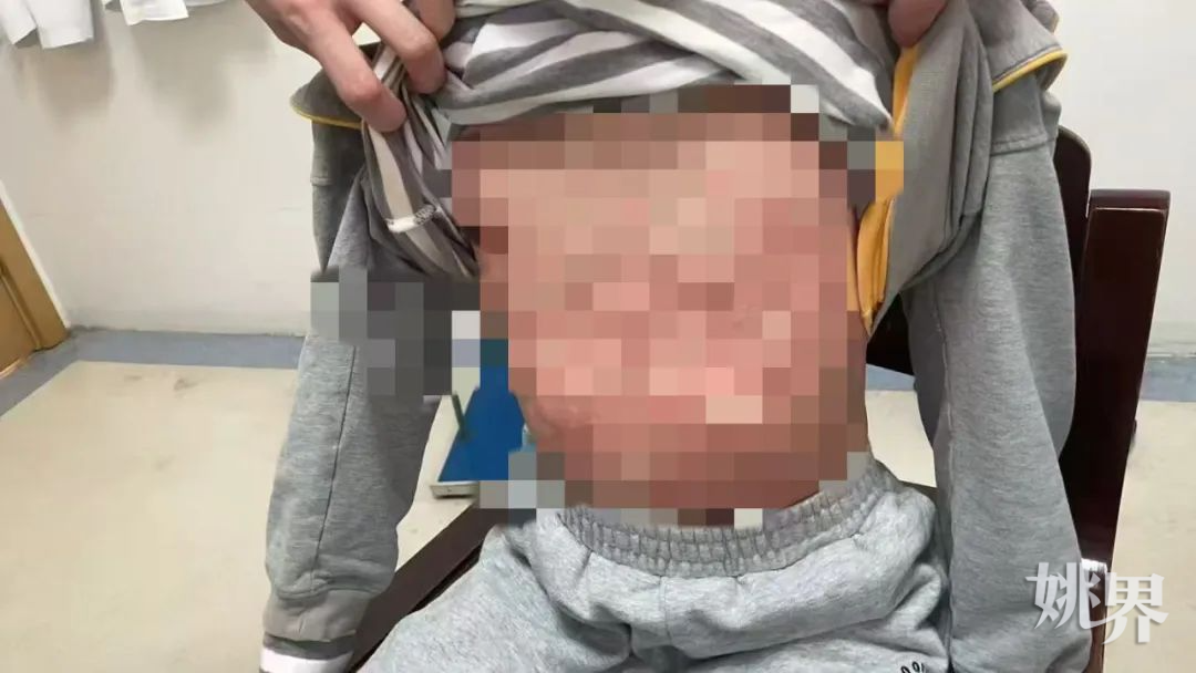  触目惊心！宁波9岁男孩春游后出事了！紧急提醒→